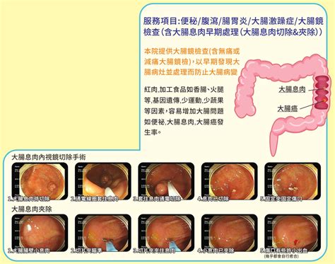 重光醫院肝膽腸胃科門診時間|肝膽腸胃科